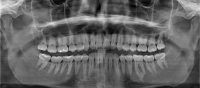 Diagnosi radiologica